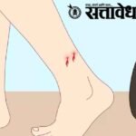 Snakebite notified disease : सर्पदंश आता ‘अधिसूचित आजार’