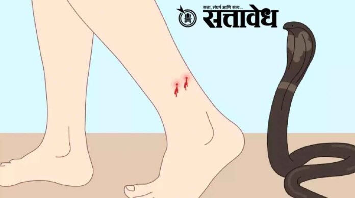 Snakebite notified disease